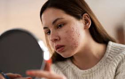 چرا پوست جوش می‌زند و چطور آن را کنترل کنیم؟